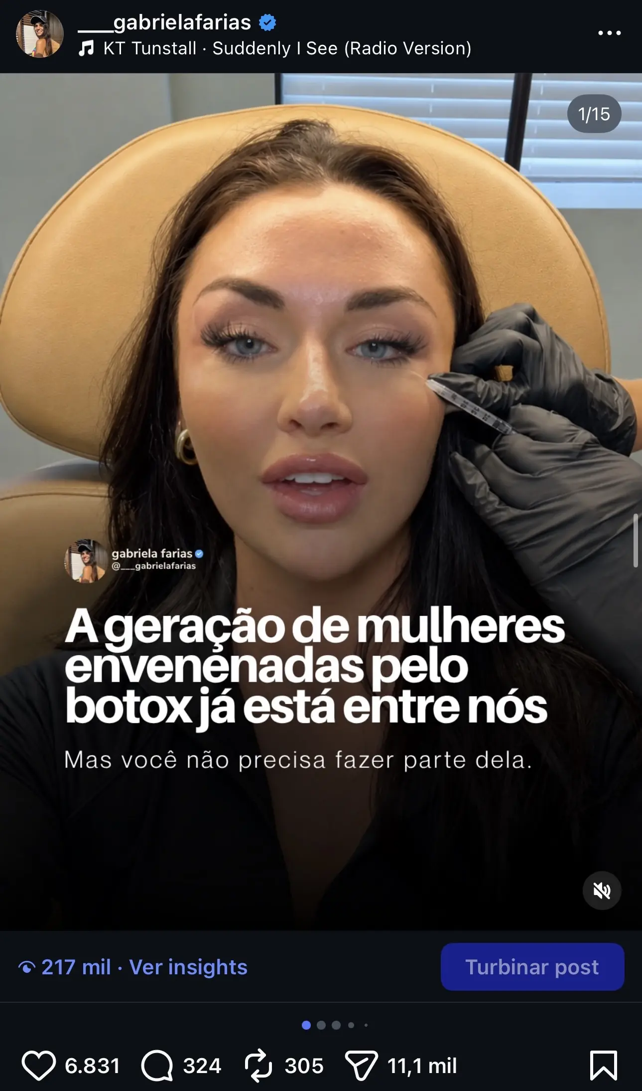 conteúdo